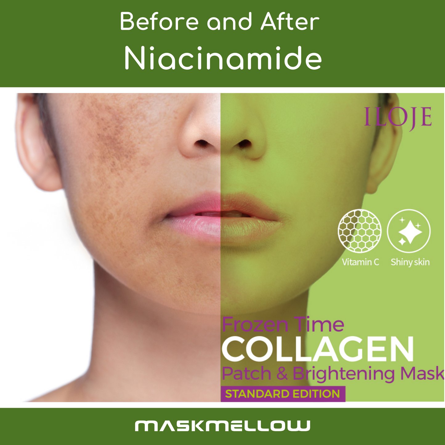 ILOJE Frozen Time Collagen Patch & Brightening Mask